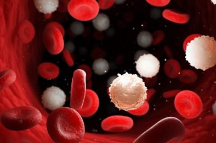 3d rendered medically accurate illustration of too many white blood cells due to leukemia